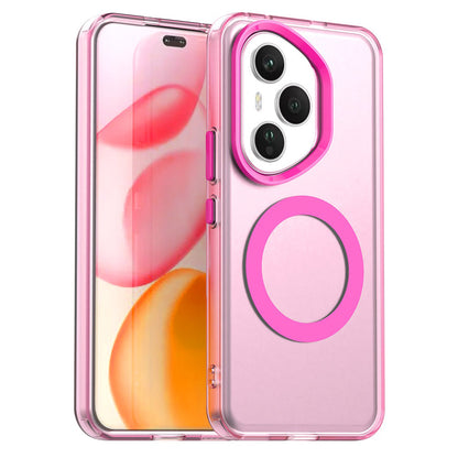 MagSafe futrola za Honor 400 Pro, Techsuit, CandyCase, Roze
