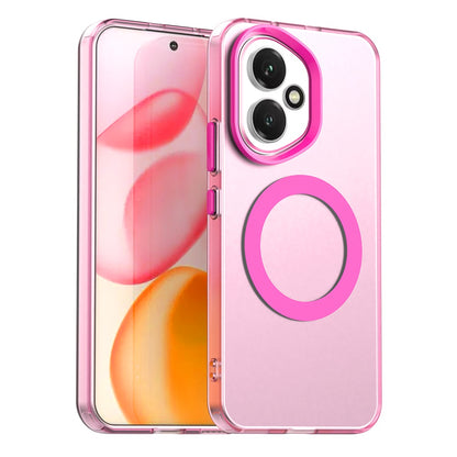 MagSafe futrola za Honor 400, Techsuit, CandyCase, Roze